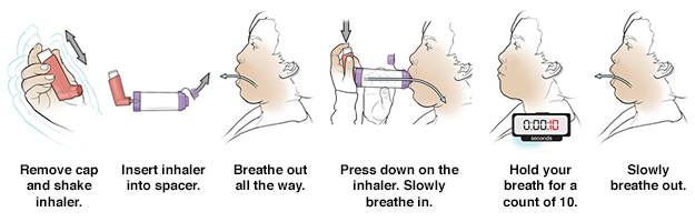 discharge-instructions-using-a-metered-dose-inhaler-sterling-care