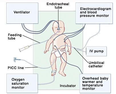 Equipment in the NICU - Sterling Care - In-Home Care Westchester NY ...